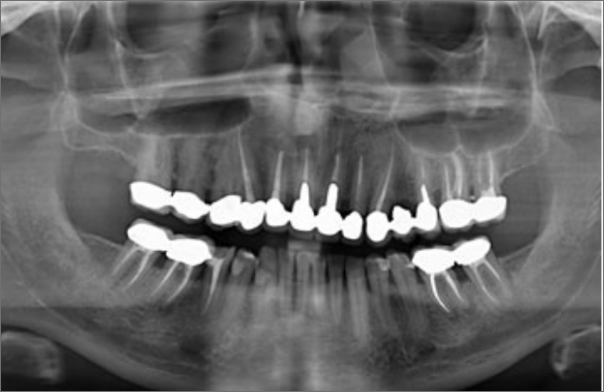 Conservativa ed Endodonzia