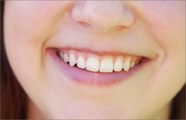 Metodo Top Gum ®